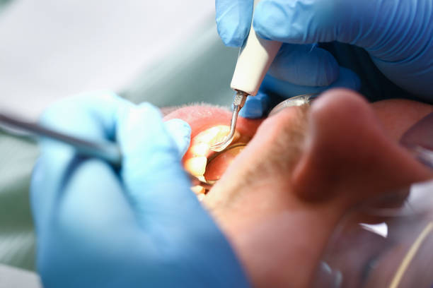 Best Broken or Cracked Tooth Emergency Dentist in Cedarville, OH